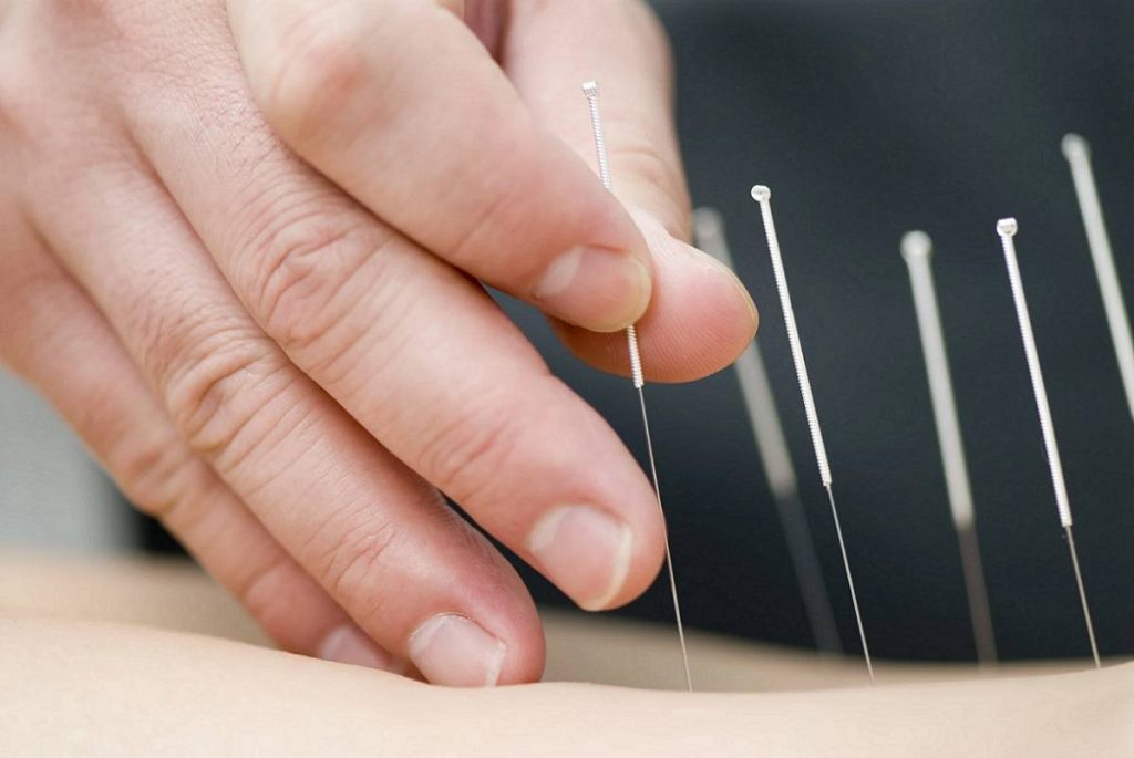 طب سوزنی چه بیماریهایی را درمان میکند